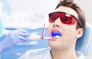 Laser Gum Shaping & Gum Treatment
