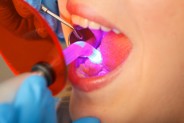 Reconstructive & Restorative Dentistry