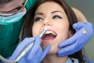 Teeth Cleaning Dental Services - Honolulu Dentist - Ala Moana - Waikiki Hawaii