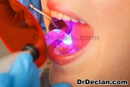Dental Bonding - Honolulu Dentist - Ala Moana Dental Care Hawaii